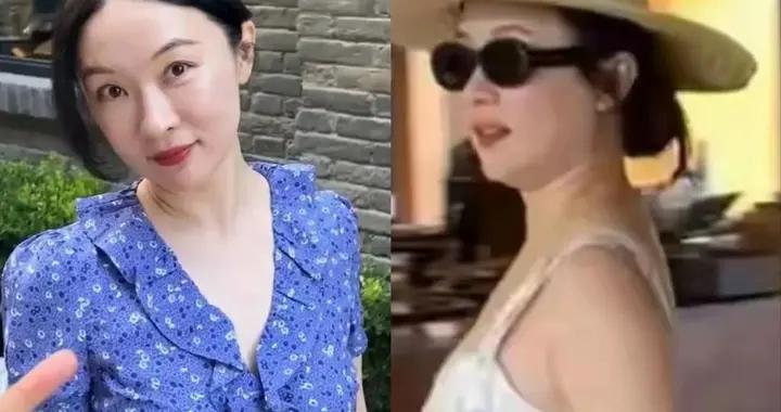 44歲霍思燕逛北京胡同，穿小短裙一點都不胖，腳上有傷讓人心疼