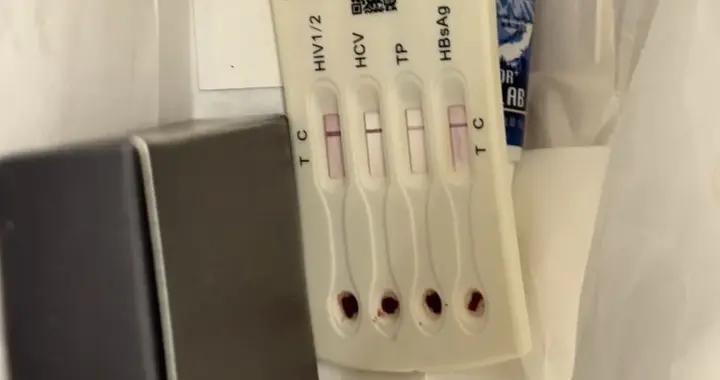 洗漱包裏驚現“帶血跡陽性HIV試劑”，知名連鎖酒店回應：涉事員工已被處理