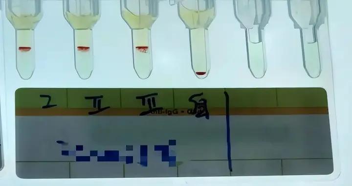 雲南檢出一例！比熊貓血還稀有小p血型是什麼？