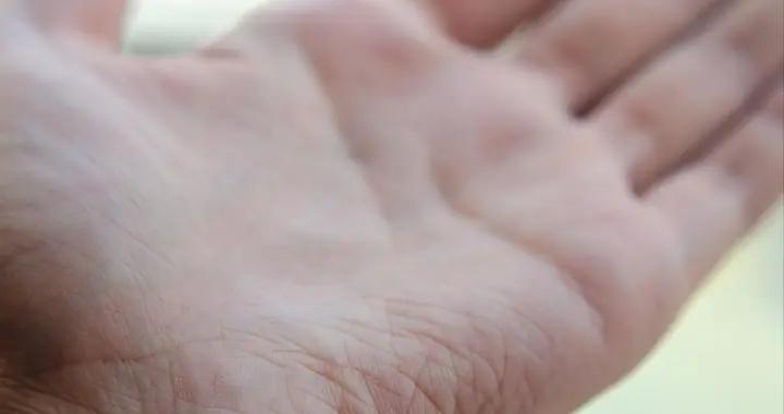 男人手掌總冒汗？這些“幕後推手”，你中招了幾個？