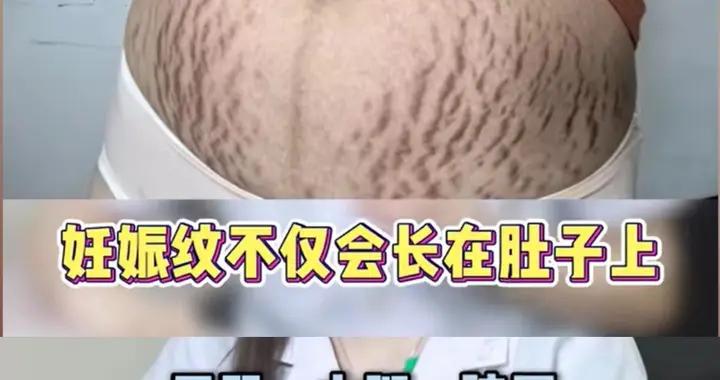 醫生揭露5個生育真相：男人要感恩！網友：孤兒院領養和無痛後媽