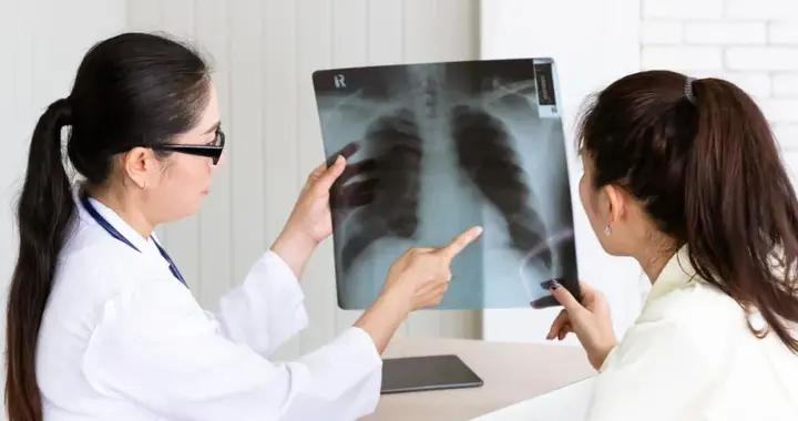 在中國，爲什麼不吸菸者中也有很多肺癌患者? | 商周專欄