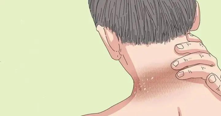 脖子、腋下、肘窩發黑，最好查查血糖