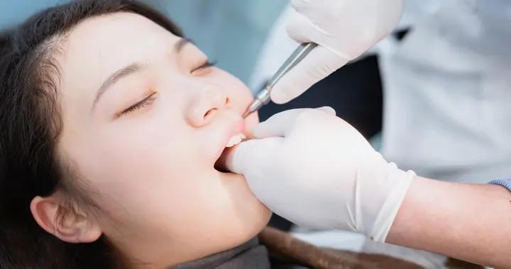 牙齒被“蟲子”蛀了？別愁，不同階段治療方法全在這