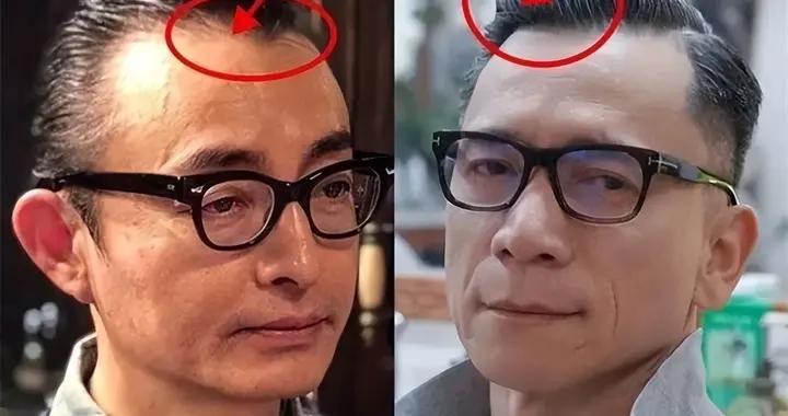 4種經典“中國式大爺髮型”，油膩顯老沒氣質，尤其第一種很常見