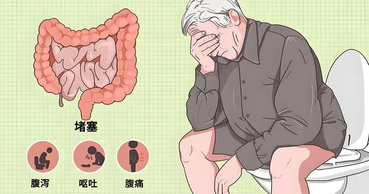 便祕嚴重，排便困難？這幾招可有效減少“蹲坑”的時間，不妨試試