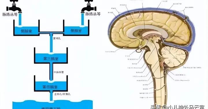淺談嬰兒腦積水的規範治療