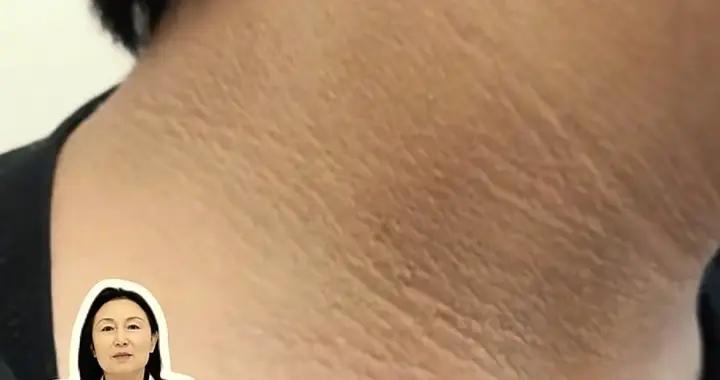 醫生：兩類孩子再愛乾淨三部位也會髒，馬上減肥否則危及生命