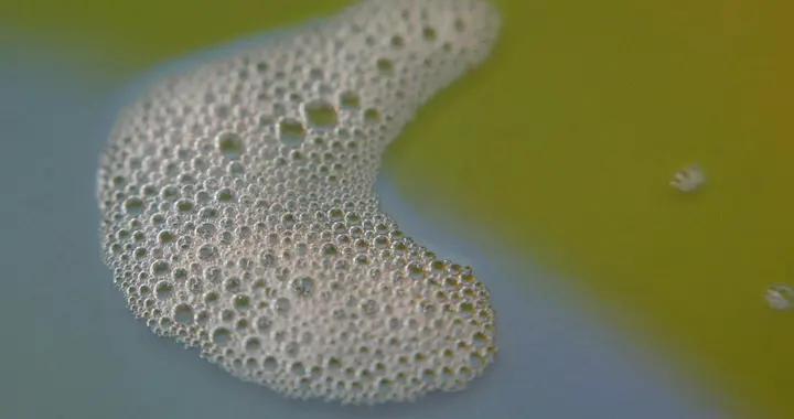 撒尿時泡沫多，是大病前兆嗎？醫生揭祕：這情況要警惕