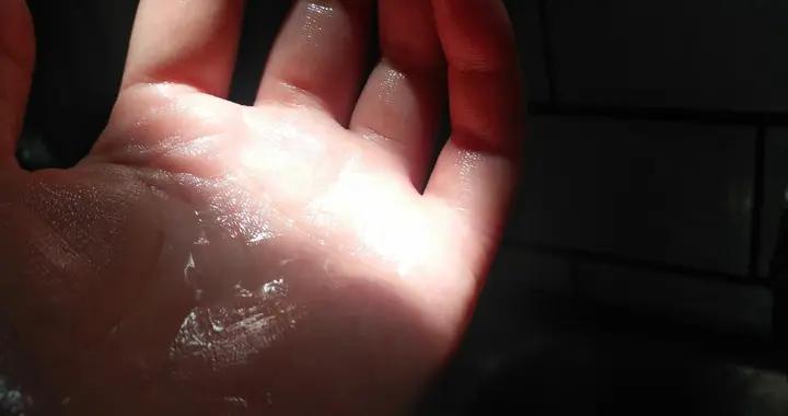 別忽視手心腳心出汗！從環境到健康，這些誘因你可能都沒在意