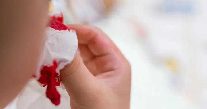 總流鼻血別忽視！從局部到全身，這些原因可能在作祟