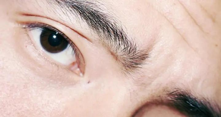 爲啥你眉心早早就有豎紋？表情多、防曬差是誘因，科學應對方法