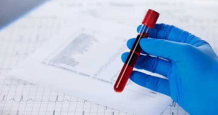 要做生化檢查的看這！包含的項目都列好啦，每個項目查啥一次說透