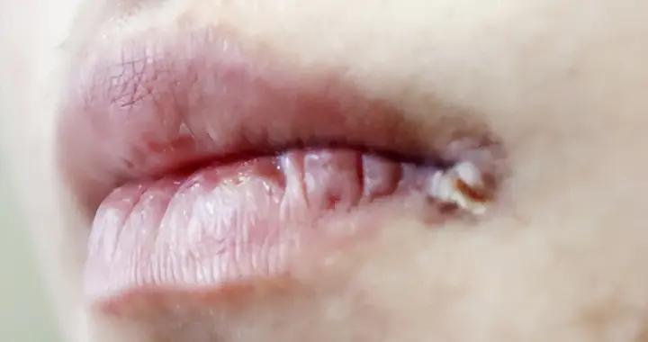 每天醒來口苦？不是小事！這些不良習慣可能是“元兇”，快改