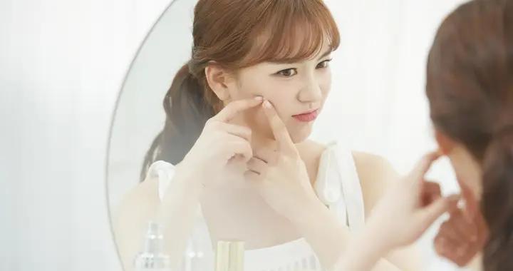 想要無痘膚質不難！溫和調理方案不刺激皮膚，敏感肌也能放心試