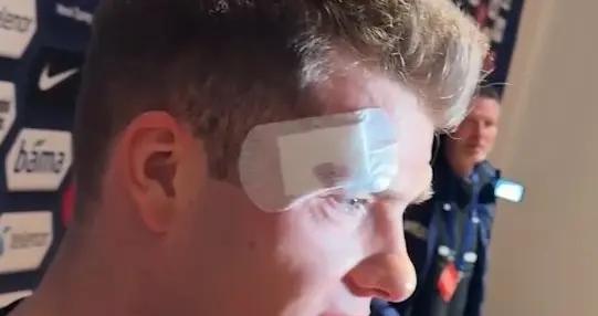 因頭部相撞被換下，瑟洛特報平安：好在我沒有腦震盪