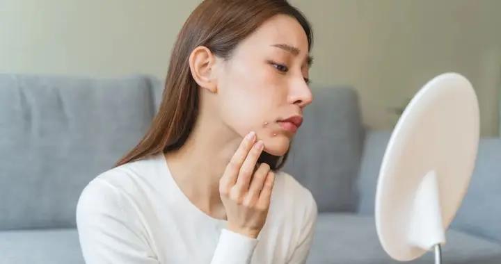 幾塊錢一支的甲硝唑，真不是皮膚神藥！別再濫用了