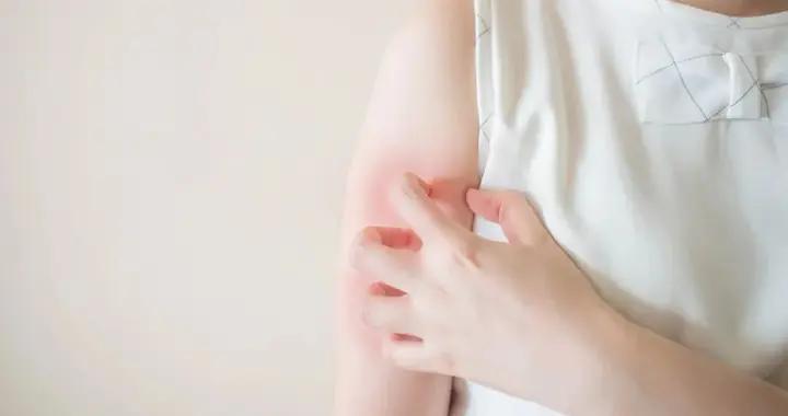 最近！身上莫名出現紅疙瘩，立刻打開這篇！