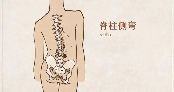 脊柱側彎要及時干預，中醫方法守護孩子脊柱健康