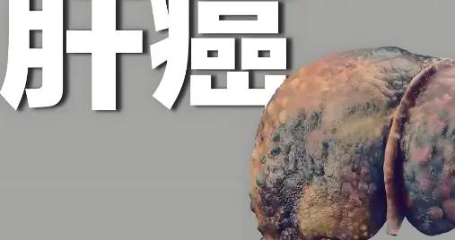 肝癌晚期“警報拉響”，中醫視角爲你撥雲見日