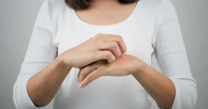 一到冬天皮膚就發癢，先改掉這兩個習慣