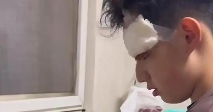 關凌深夜向兒子道歉：我一失手、他縫了四針，臉上怕是要留疤了