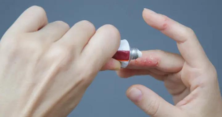 醫生緊急提醒：紅黴素軟膏千萬不能隨便用！趕緊告訴家裏人