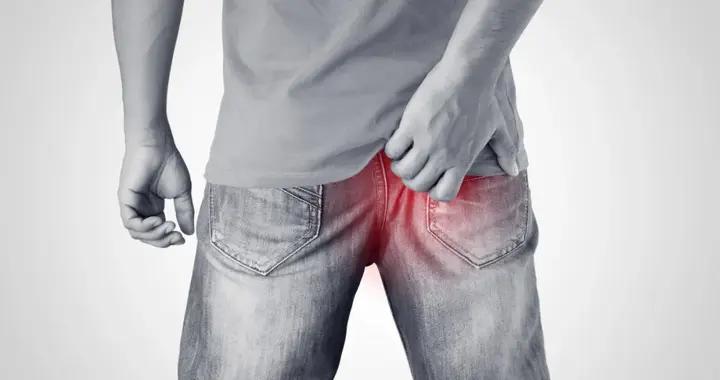 大腿根部、臀部發紅髮癢長小疙瘩脫皮，是得了溼疹？