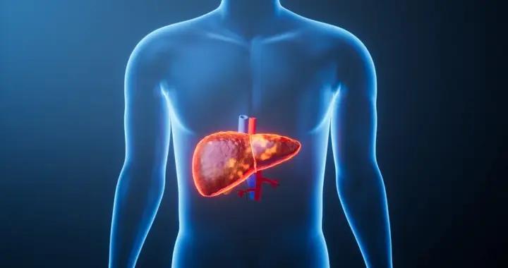 喫素就能預防或治好脂肪肝？