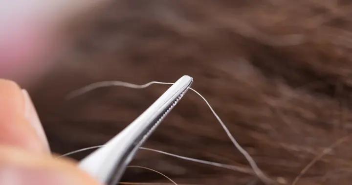 彆着急拔，這4種白髮還有逆轉的機會