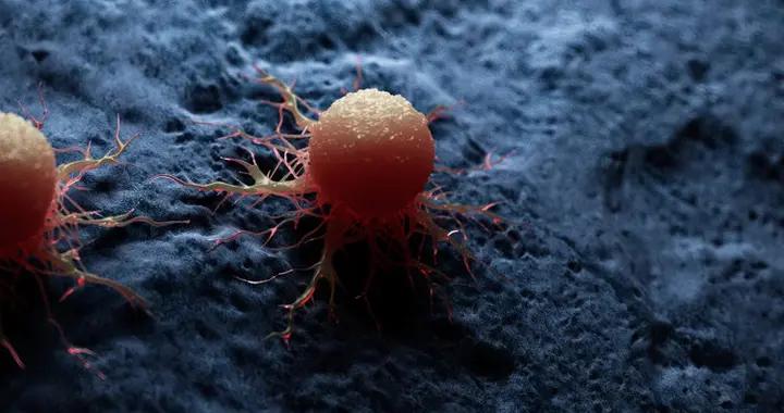 癌症是基因裏帶來的，躲也躲不掉？父母得了5種癌，子女或會繼承