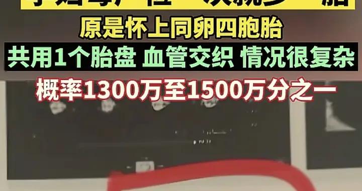 產檢4次從單胎變成四胞胎，孕媽又驚又喜，醫生搖頭：要不了