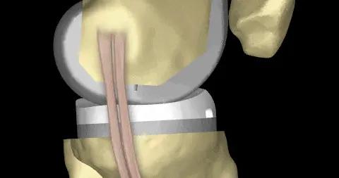 可能致癌！這東西很多人家裏都有，求求你們趕緊扔了！