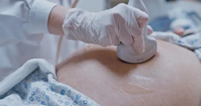 總是流產太痛苦！上海四大三甲團隊解鎖反覆流產密碼，開發精準治療新可能