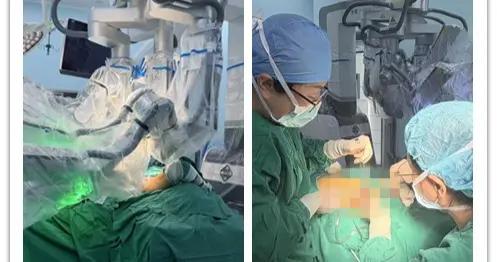 她兩次患癌仍想保乳，上海醫生用國產單孔手術機器人實現“隱形”手術