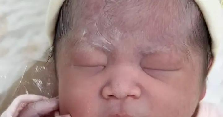 孩子出生“沒眼睛”，產後媽媽嚇得大哭：瞎子！醫生：遺傳，沒事