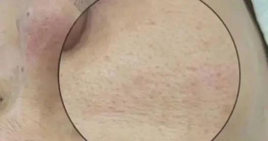 皮膚：人類進化與中醫智慧