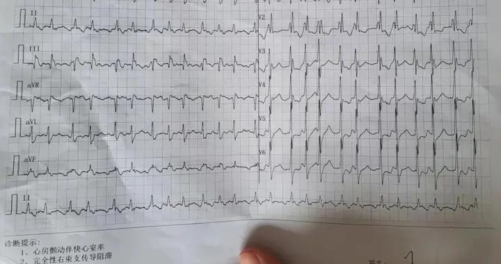 “你的主動脈就像快被打爆的車胎，哪天破了，人可能直接就沒了”