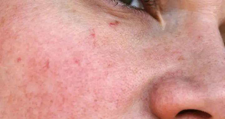 爲什麼說“厚臉皮”是中年人最好的保護色？