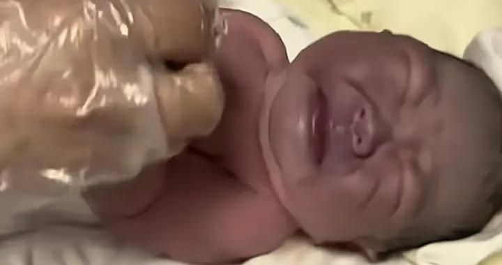 爲生白皙寶寶媽媽狂喫水果，結果生出“黑包公”，醫生：智力受損