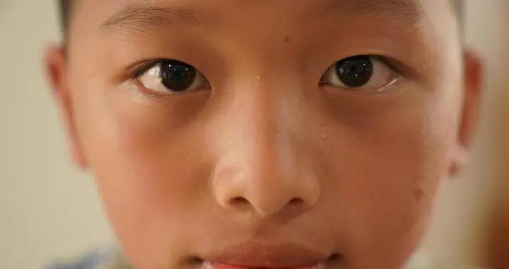 小孩越來越黑？可能是這些營養素在“喊缺”