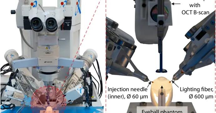 能做眼底注射的機器人來了！平均定位誤差比醫生減少近80%