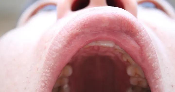 說話不清、答非所問？可能是語言障礙！這些症狀要警惕