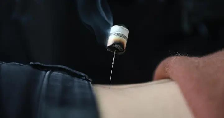 溼氣重別愁！女性艾灸選對穴位是關鍵，溫化溼氣有妙招