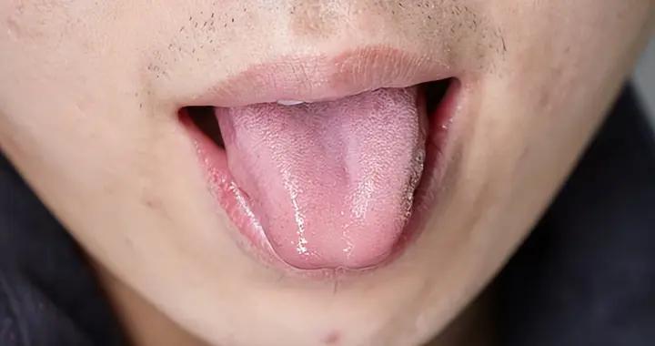 溼氣重的人，身體會有啥表現？這幾個“不對勁”別忽視