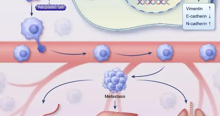 牙沒刷好，竟然會助推癌細胞轉移？看完立馬想去刷牙！