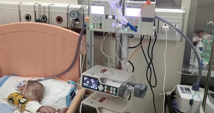 文獻報道成功率不超50%！戴着呼吸機接受移植，上海醫生爲2歲寶寶贏得生機