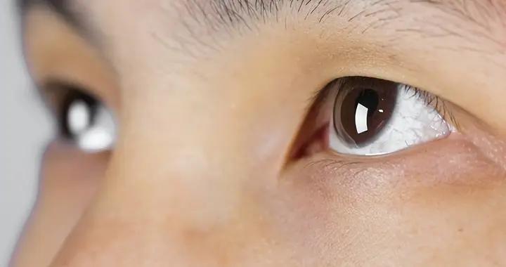 女生右眼跳啥意思？別信“跳災”，多是疲勞或壓力在“搞怪”