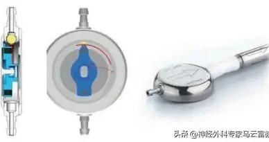 腦積水專欄-第42期（腦積水術後腦室腹腔分流管閥門相關科普）