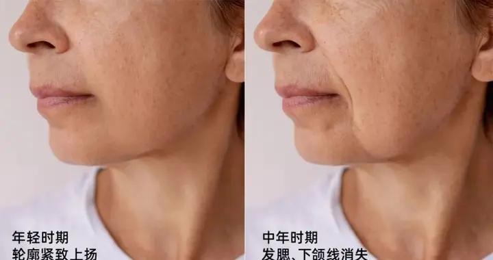 爲什麼有的人臉上沒什麼皺紋，但你一看就覺得她老了？